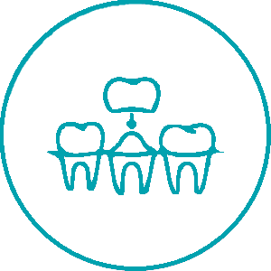 Implantes y Extracciones Dentales